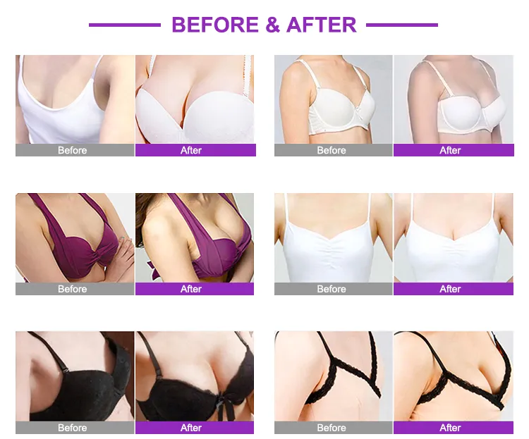 বিট হপ পাম্প বৃহত্তর ম্যাসেজার সৌন্দর্য শরীরের আকৃতি ক্যাপিং ভ্যাকুয়াম থেরাপি মেশিন 4